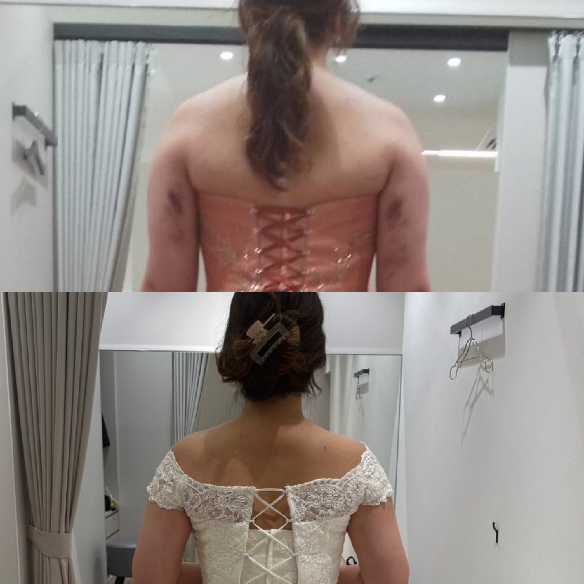 ブライダルエステ11回頑張った結果!!背中に隙間が☆