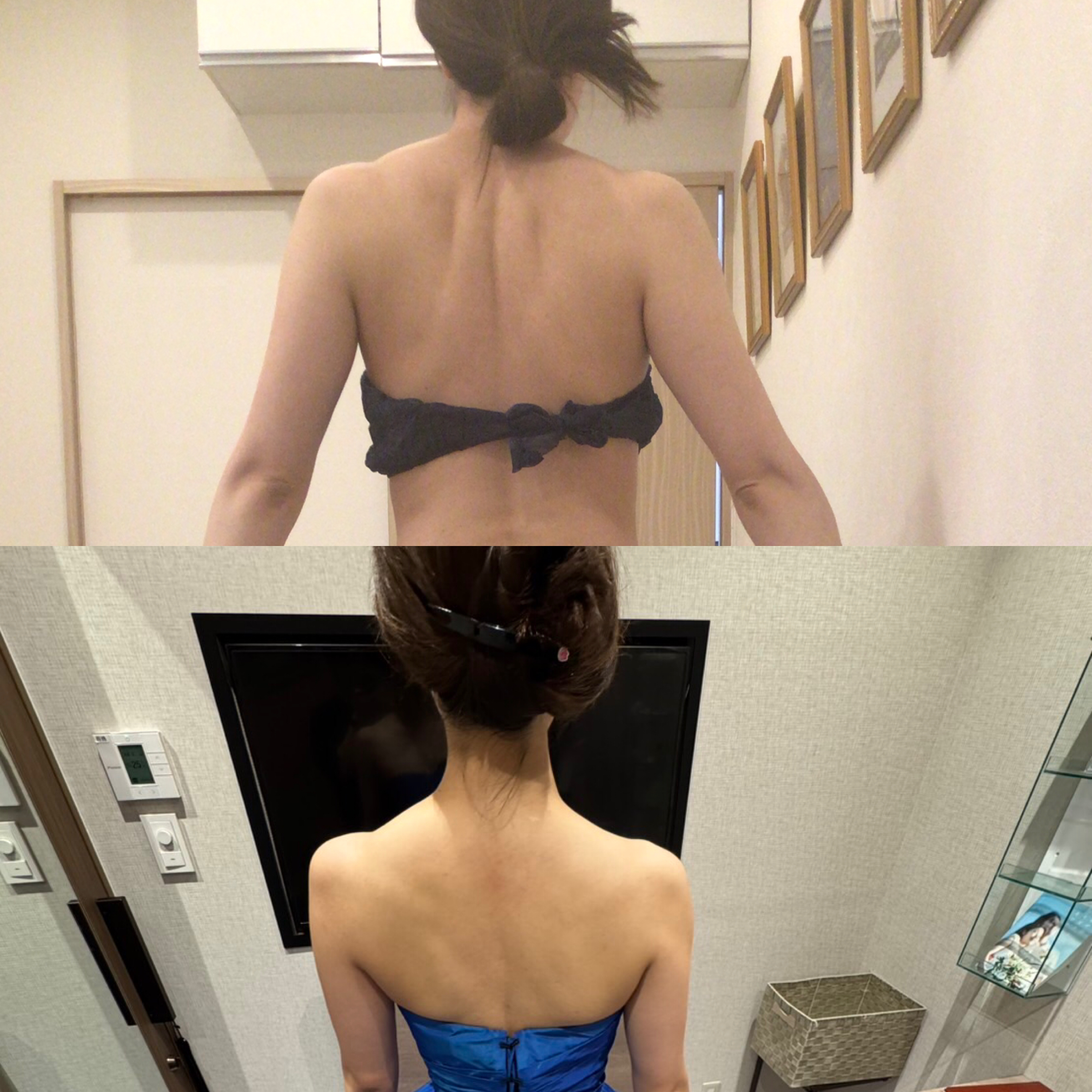 1番人気☆ブライダル特別体験(背上～二の腕・肩・首・ドレスからはみ出た脇肉)