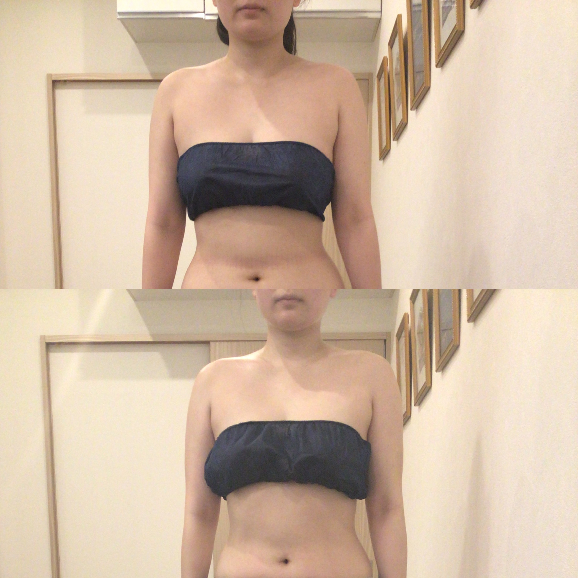 ブライダルだけでない!!薄着なる前に上半身＆小顔美人(梅田/西梅田/北新地)