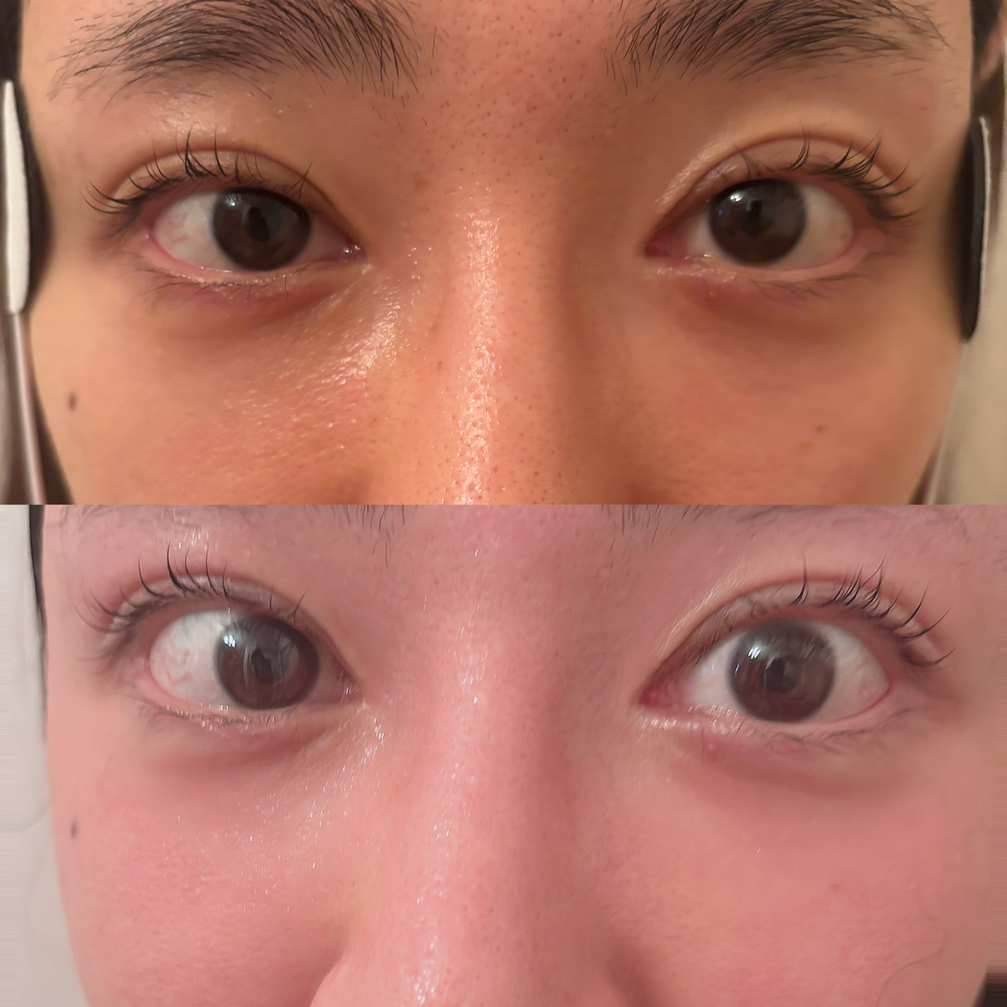 今の現代病のお悩み『眼精疲労』梅田/西梅田/北新地