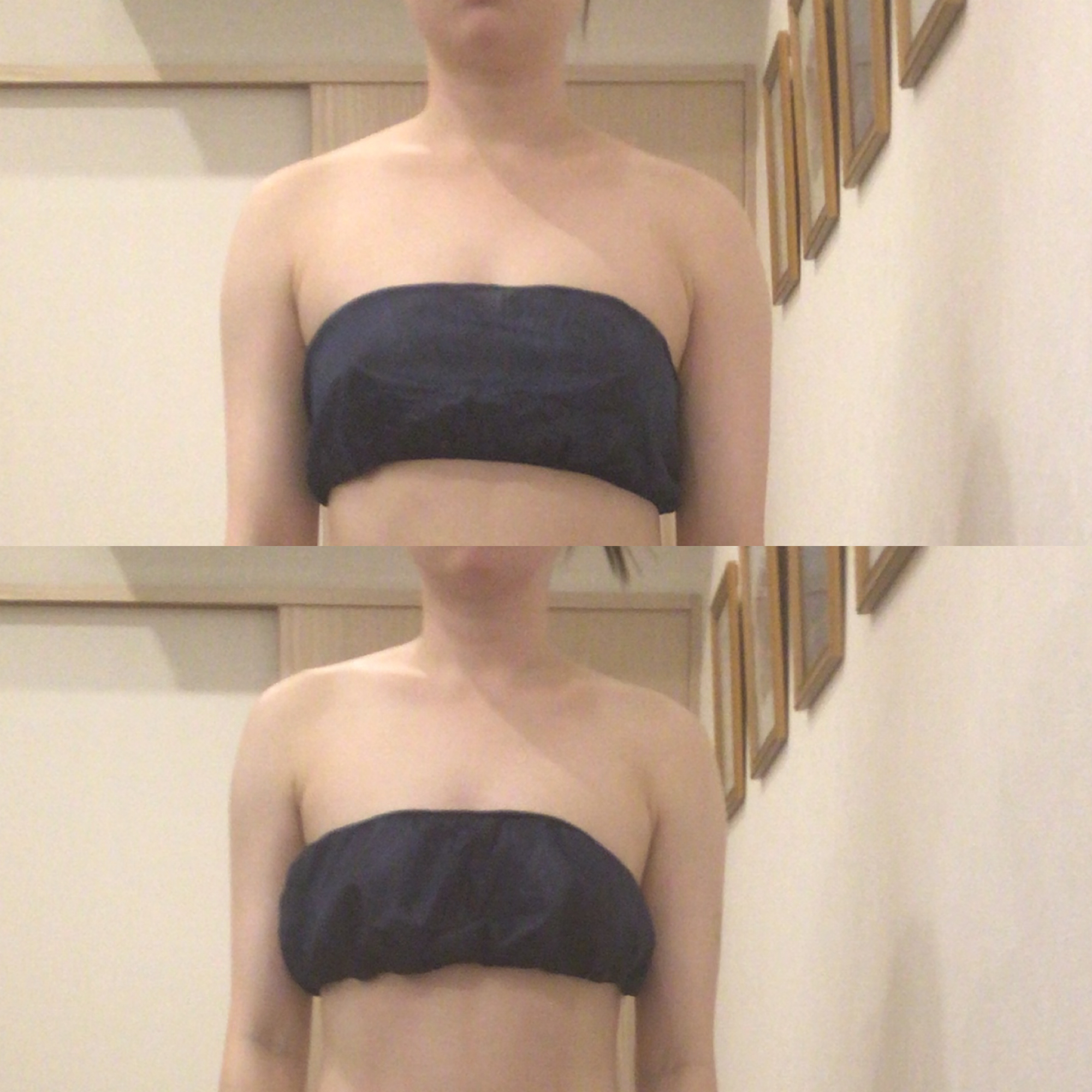 ご結婚式に向けて～背中・二の腕スッキリ集中コース＆デコルテのみお客様も増えてます☆(梅田/西梅田/北新地)